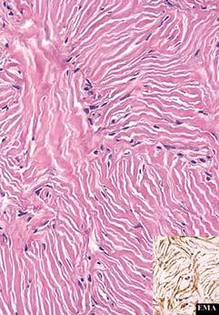 mediastinum May be represented histologically by neurofibroma,