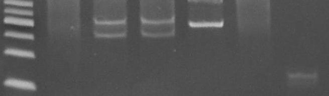 IGH@ gene rearrangement and PCR gel-based PCR product detection