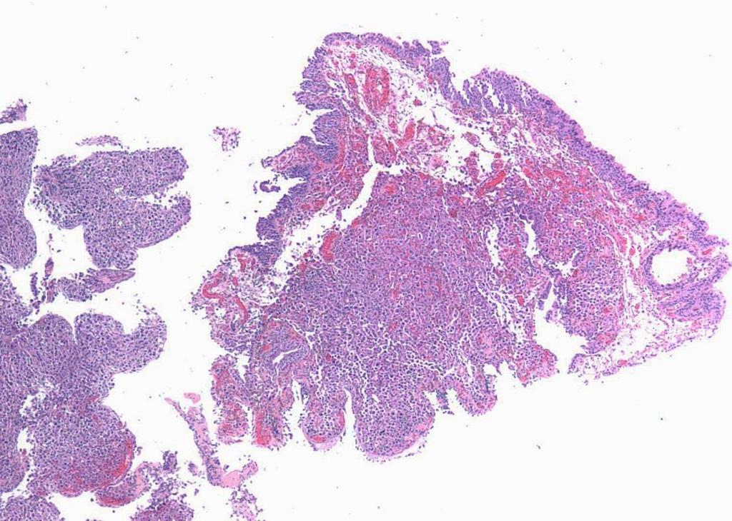 Case Presentation 49 year-old male with