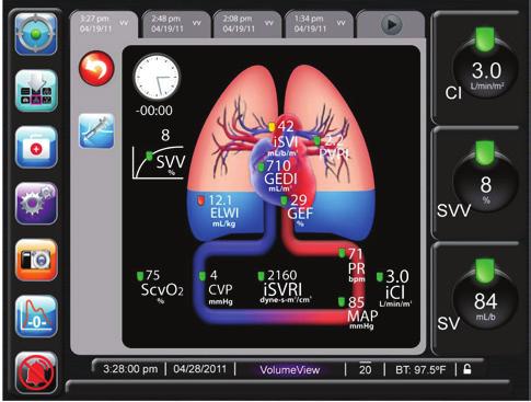 The physio-relationship screen depicts the balance between oxygen delivery and consumption, allowing you to identify the root cause of the imbalance and the most appropriate intervention.