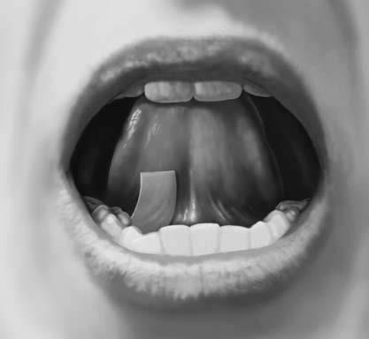To take SUBOXONE sublingual film under your tongue (sublingual administration): Hold the film
