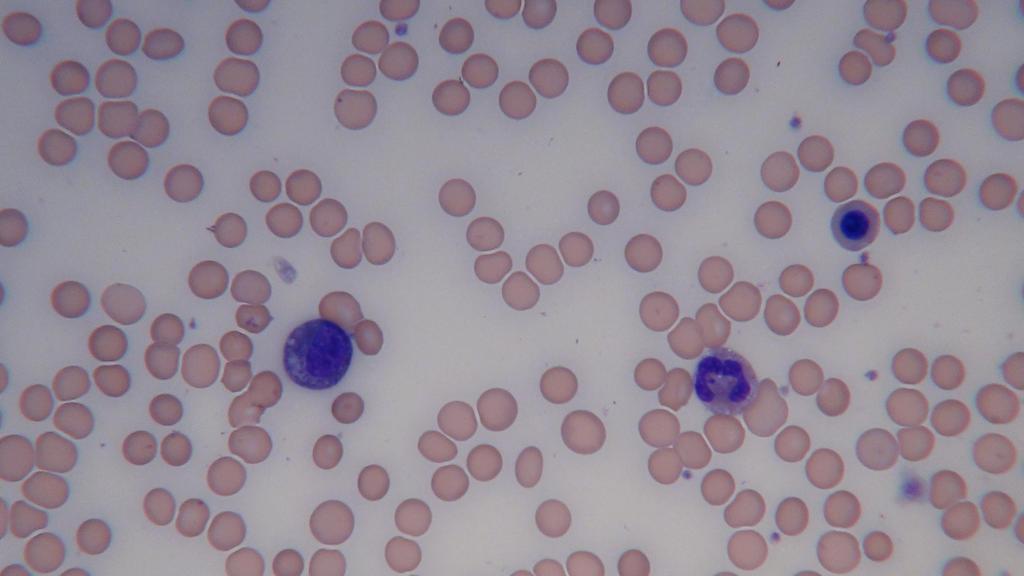 Macrocytic, normochromic anemia with anisopoikilocytosis and polychromasia.