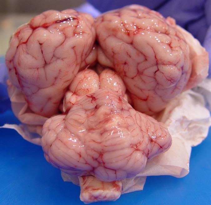caudal cerebral cortex