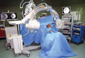 IV. Intraoperative Fluoroscopy At the present time, interoperative fluoroscopy is the most accurate method to measure and document ACL femoral tunnel placement.