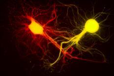 motor neuron efferent cell body interneuron associative