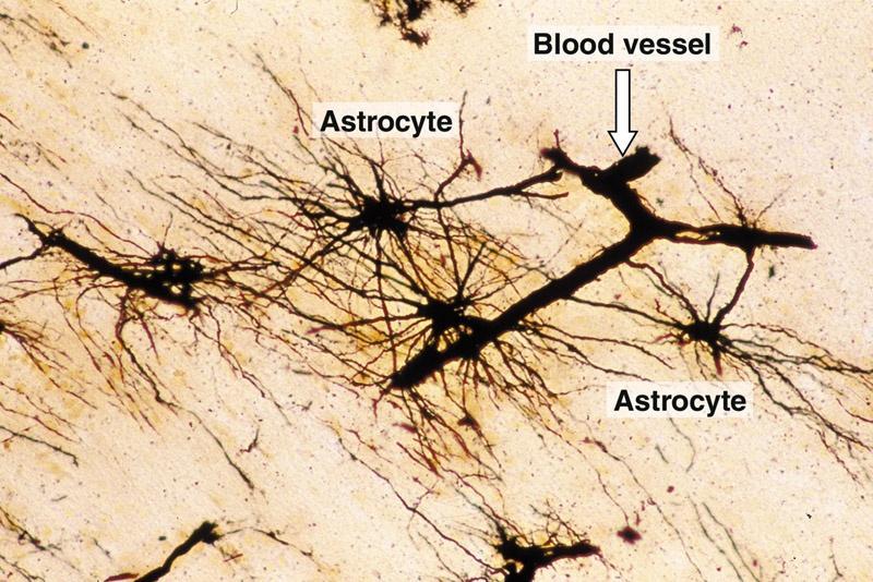 Brain section prepared with Rio Hortega silver stain showing fibrous astrocytes with