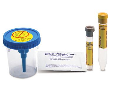The transfer of the urine into the PCR tube can be done post transport if delivery to the laboratory takes place within 24 hours of collection.