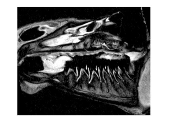 dental imaging Periodontal disease