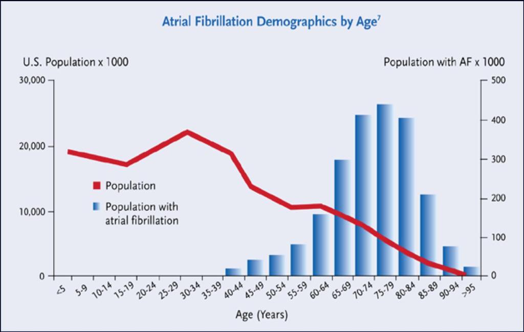 Atrial Fibrillation Increased prevalence in the elderly Feinberg