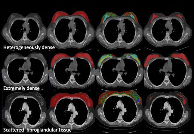 Using a large clinical repository of CT images