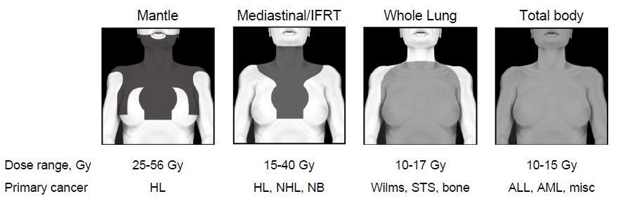 Radiation Fields Dose: mantle > mediastinal/ifrt > whole lung,