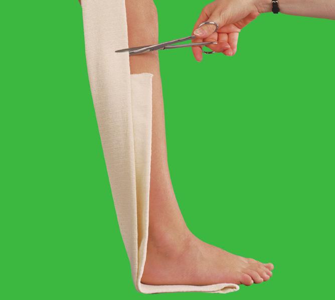 Indications Tubigrip provides tissue support in the treatment of strains and sprains, soft tissue injuries, general edema, post- burn scarring and ribcage