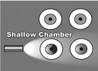 Deep chamber: illumination of nasal iris Shallow chamber: