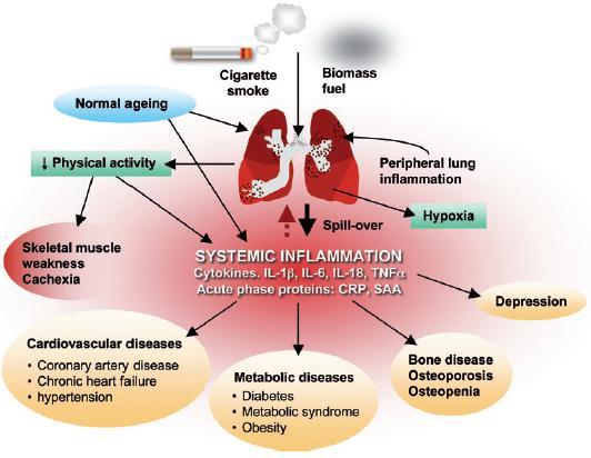 Inflammatory pathways involved in the cardiopulmonary