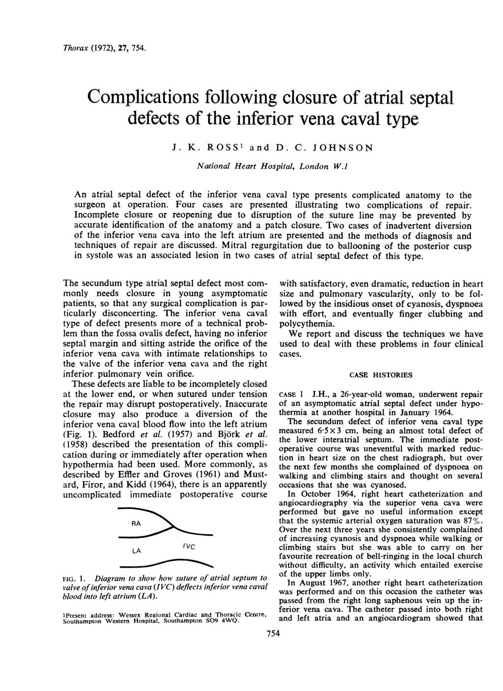 Thorax (1972), 27, 754. Complications following closure of atrial septal defects of the inferior vena caval type J. K. ROSS1 and D. C. JOHNSON National Heart Hospital, London W.