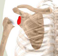 instability) A torn or damaged biceps tendon A torn rotator cuff A bone spur or inflammation around the rotator cuff Stiffness of the shoulder Arthroscopy may be recommended for shoulder problems,