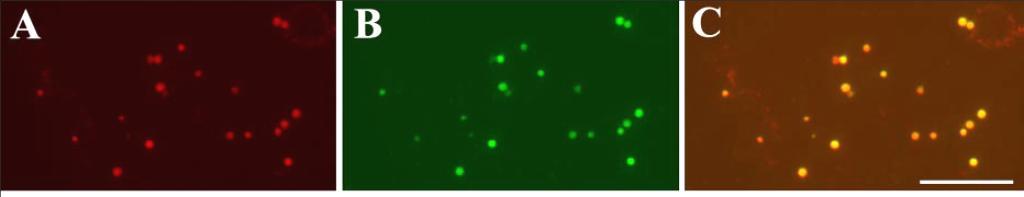 with cortical microtubules (GFP-alpha-6 tubulin).