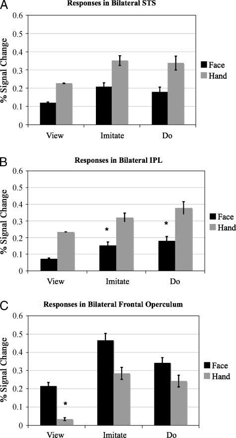 location of the mean peak for viewing facial expressions in the right hemisphere was significantly more anterior and inferior than the location of the peak response for viewing social hand gestures (