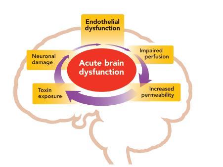 Acute Brain Dysfunction During Critical Illness Result of Inflammation