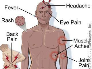 Symptoms of