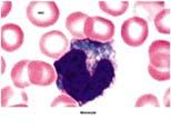 vessels and heparin prevent blood clotting Similar to mast cells (found in the tissues) Monocytes 2 8% of circulating WBCs Are large, irregular shape