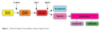 Slide 7 Mechanism Mechanism of gastric carcinogenesis complicated and largely unknown Majority is associated with histologically recognizable premalignant stages first described by Pelayo Correa in
