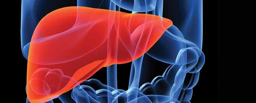 2 Alcoholic Liver Disease Alcoholic liver disease is the second leading indication for liver transplantation in the United States.