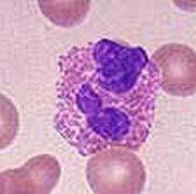 What is an Eosinophil?
