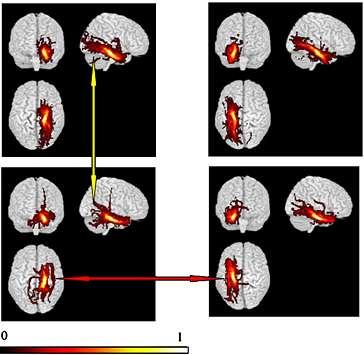 Control DTT in Epilepsy Structure-Function Relationship: Memory Left Right Group maps of parahippocampal gyrus tracts (left TLE patients controls)