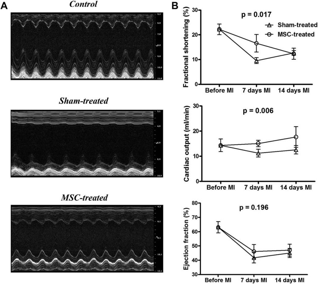 2130 Remote Transplantation of MSC is Cardioprotective Figure 4. Effect of subcutaneous transplantation of MSC on left ventricular function after myocardial infarction (MI).