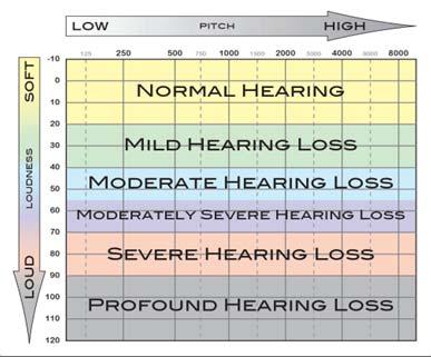 Noise induced hearing loss cont.