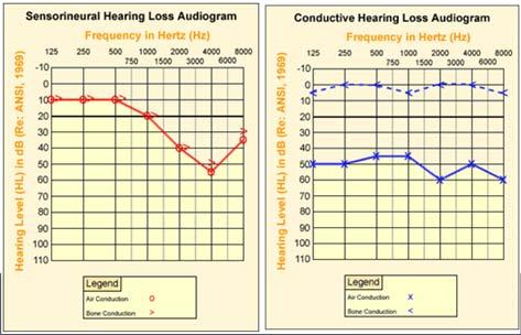 Audiogram X = Left ear O = Right ear How to find an audiologist in Ohio Visit The Ohio Academy of Audiology webpage http://ohioacademyofaudiology.