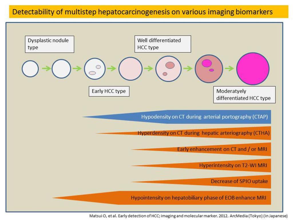 Conclusion Knowledge of imaging diagnosis methods about multistep hepatocarcinogenesis from various biological aspects, especially focused on Gd-EOB-DTPA, might be important for distinguish HCC from