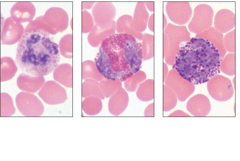 (a) Neutrophil; multilobed nucleus (b) Eosinophil; bilobed nucleus, red cytoplasmic