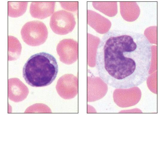 (d) Small lymphocyte; large spherical nucleus (e)