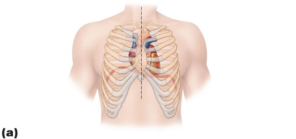 Figure 18.2a Location of the heart in the mediastinum.