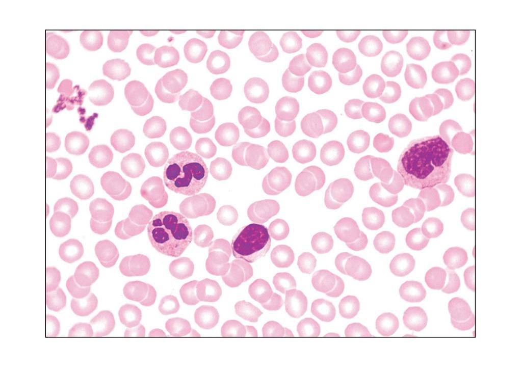 Platelets Erythrocytes Monocyte