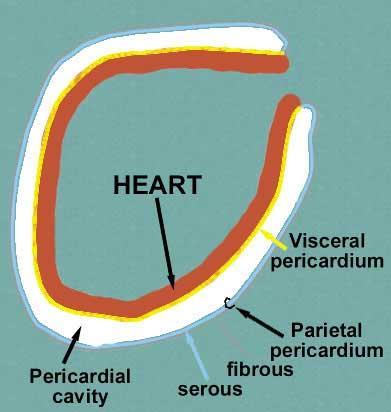 Pericarditis Pericardial inflammation Usually due to