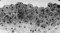 Phagocytosis of renewable discs of