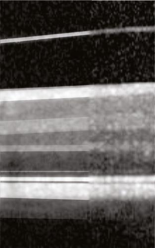 The left half of the figure is a gray-scale enhancement of the image.