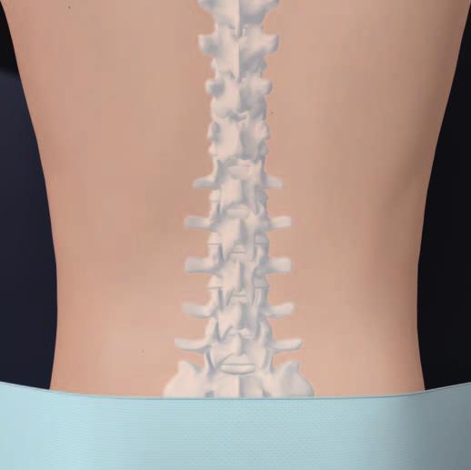 Table Fixed Retraction 1 Approach the spine The mini-open approach uses a paramedian incision made through the skin and fascia approximately 2 4 cm from the midline.