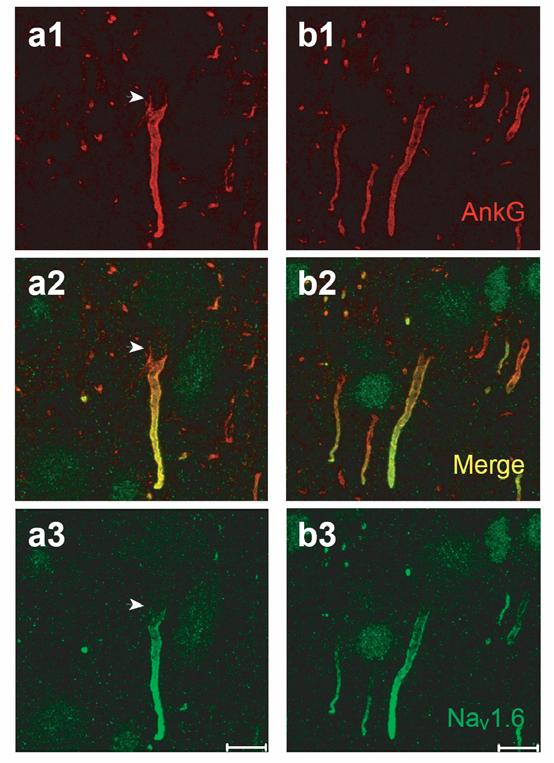 Supplementary Figure 7 Non-uniform distribution of Na v 1.6 channels at the AIS of layer 5 pyramidal neurons in somatosensory cortex. (a1 a3) Double stainings for AnkG (red) and Na v 1.6 (green).