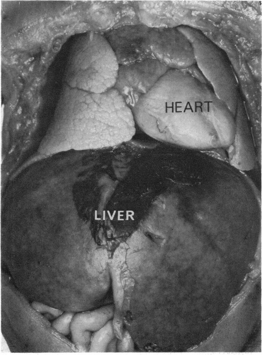 6 Allan, Tynan, Campbell, Wilkinson, Anderson inothe descending aorta. The head and neck ~~arteries ~~~' are seen ascending from the arch and the relation to the oesophagus is seen (Fig. 6).