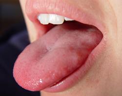 carried by saliva to the taste receptors Different shapes of molecules activate different
