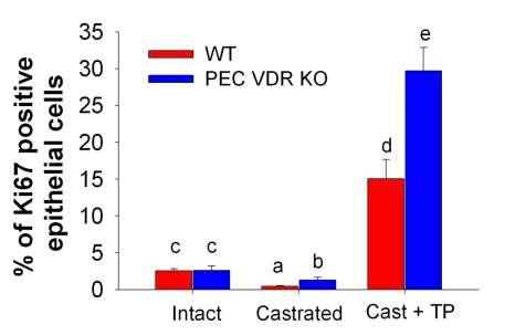 Prostate Epithelial Cell Specific VDR Deletion