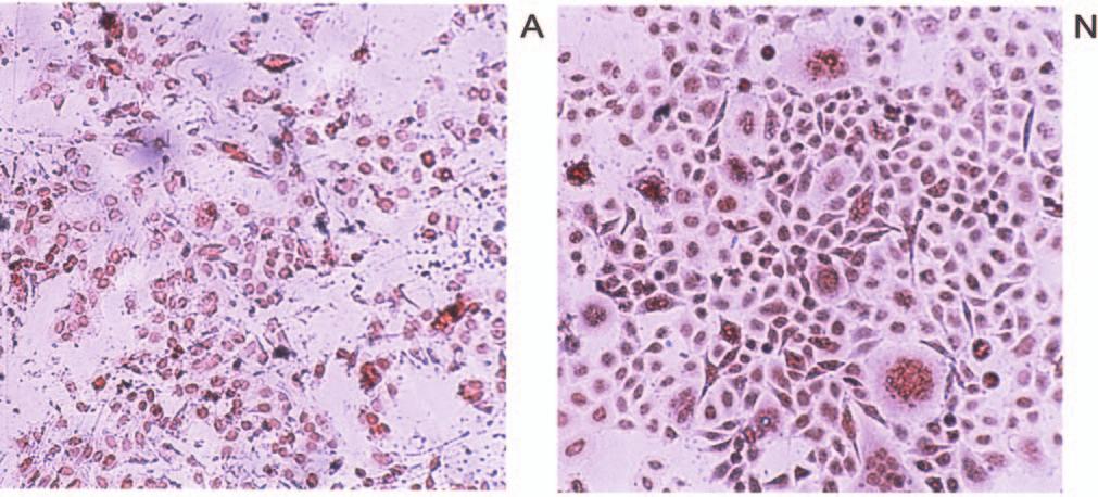 Figure 1. Immunohistochemistry of HeLa cells cultured under aerobic, anaerobic or hypoxic conditions. Cells were stained for Hif-1.