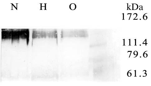Anderson et al: 2-DG and Glycolysis Figure 2. Representative Western blot of proteins from "oxic", hypoxic or anoxic HeLa cells.