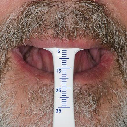 ASK THE PATIENT TO RELAX THEIR UPPER LIP Record the length of
