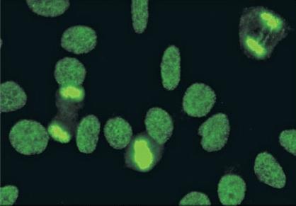 Anti-LEDGF: dense fine speckled nucleoplasmic staining