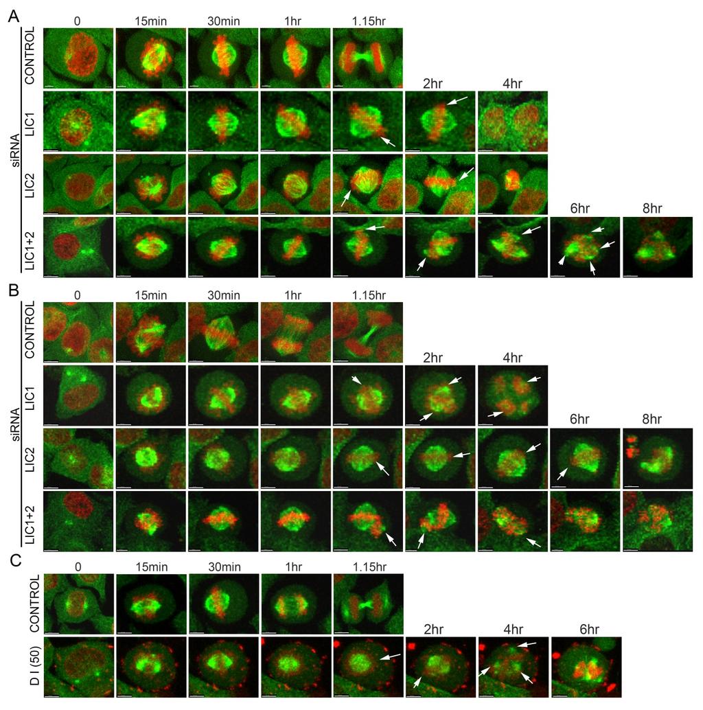 Supplementary figure S2 Supplementary figure S2: Additional figure with representative images in support of figure 1 showing that LICs are required for mitotic progression in HeLa cells.